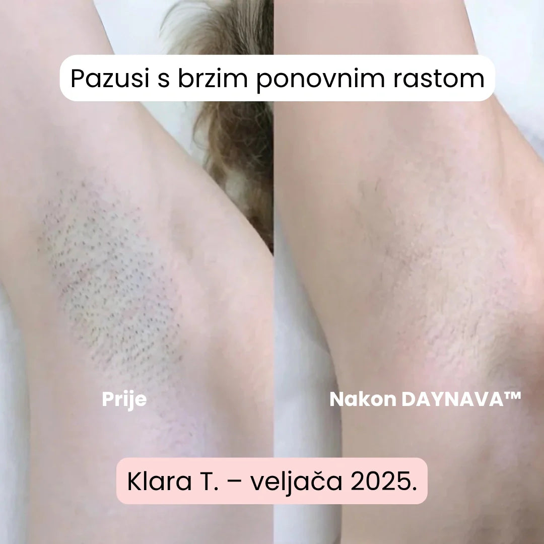 Daynava™ 5u1 Električni Brijaći Aparat