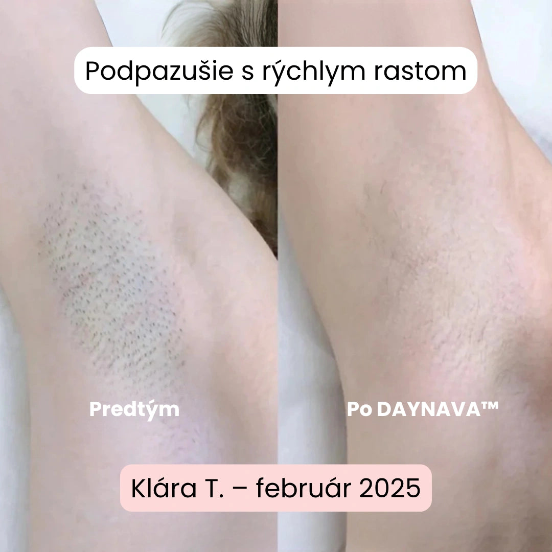 Daynava™ 5v1 Elektrický Holiaci Strojček