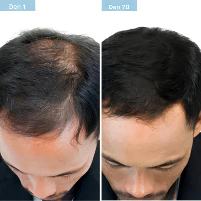 Daynava™ Roll-On pro růst vlasů