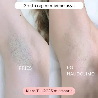 Daynava™ 5 iš 1 Elektrinis Skutimosi Įrenginys (LT)