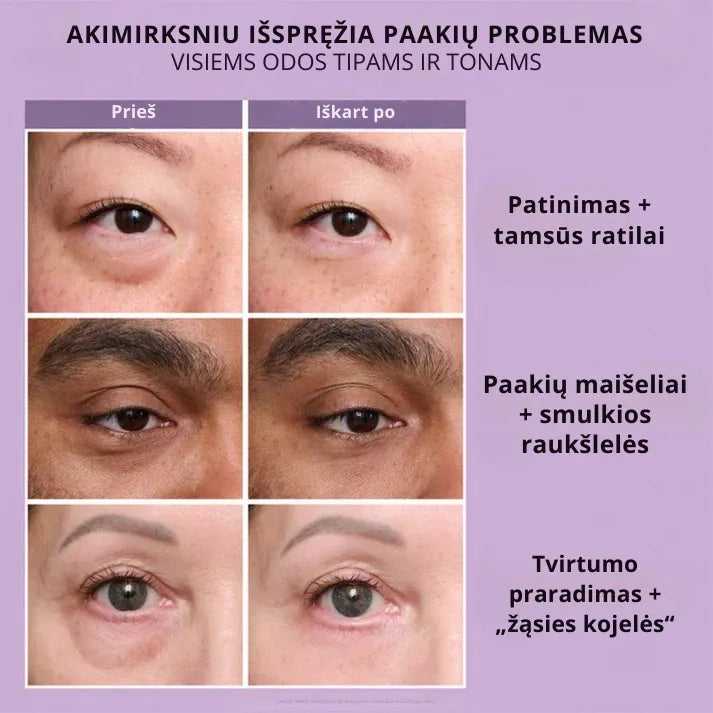 Daynava™ Momentinis Akių Pakelėjas