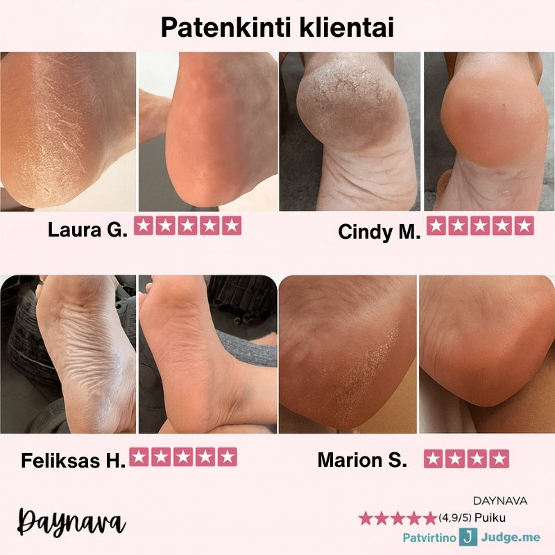 Daynava Elektrinė Pėdų Dildė