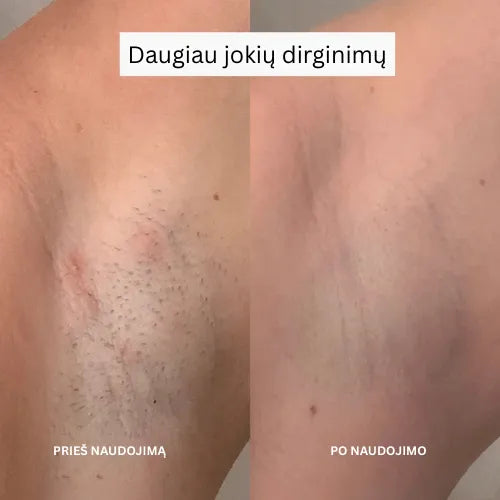 Daynava™ 5 iš 1 Elektrinis Skutimosi Įrenginys (LT)