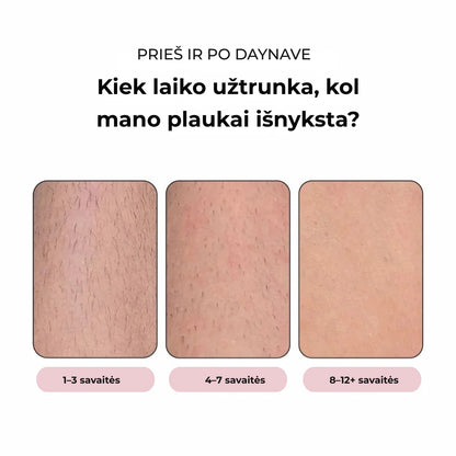 Daynava™ IPL Epiliatorius (LT)