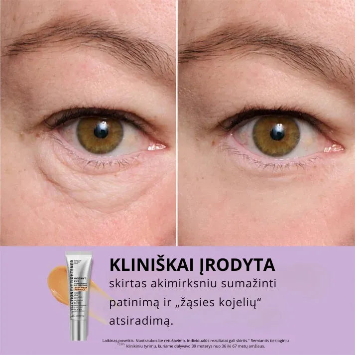 Daynava™ Momentinis Akių Pakelėjas