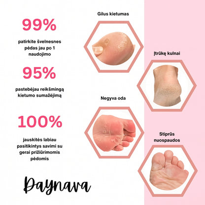 Daynava Elektrinė Pėdų Dildė