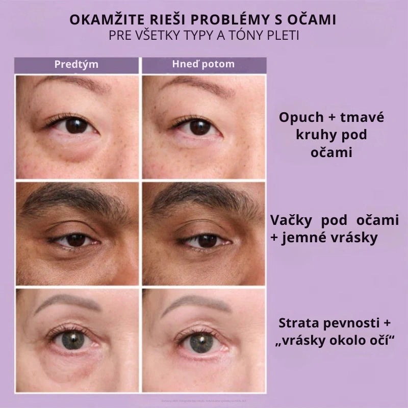 Daynava™ Okamžitý Lifter Očí