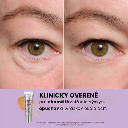 Daynava™ Okamžitý Lifter Očí