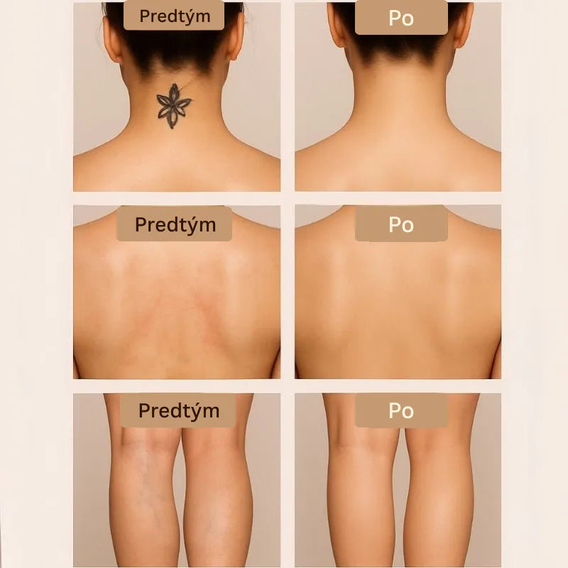 Daynava Sada Štetcov pre Body Perfecter