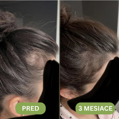 Daynava™ Hair Growth Oil