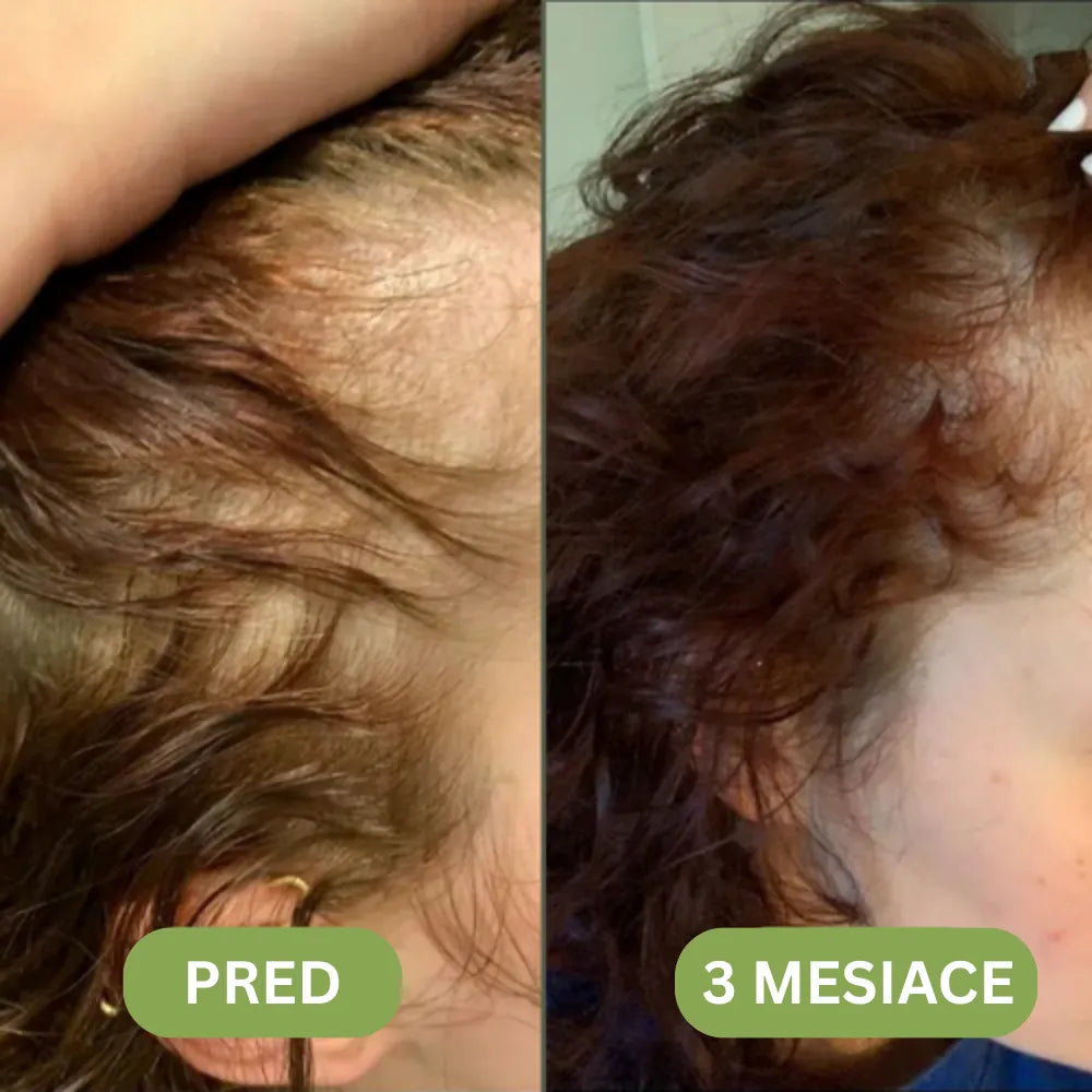 Daynava™ Hair Growth Oil