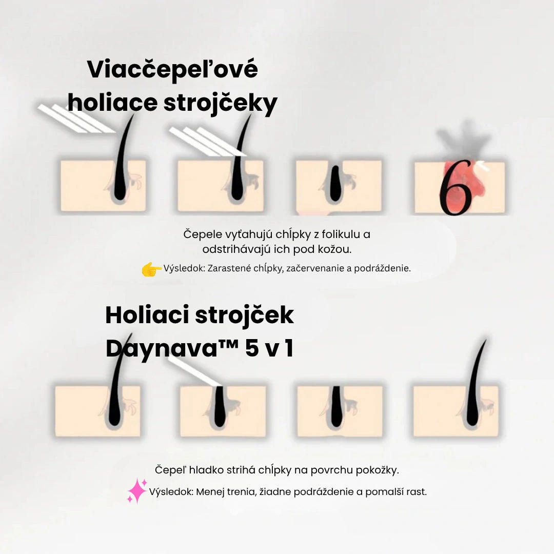Daynava™ 5-v-1 Elektrický Holiaci Strojček