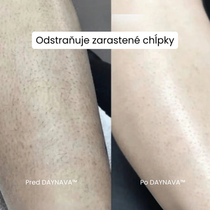 Daynava™ 5-v-1 Elektrický Holiaci Strojček