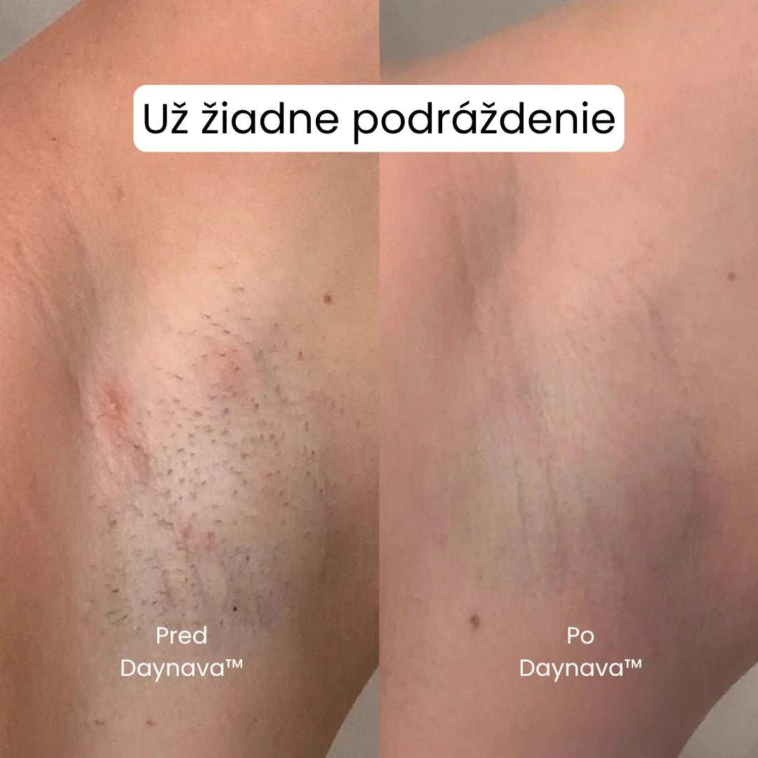 Daynava™ 5-v-1 Elektrický Holiaci Strojček