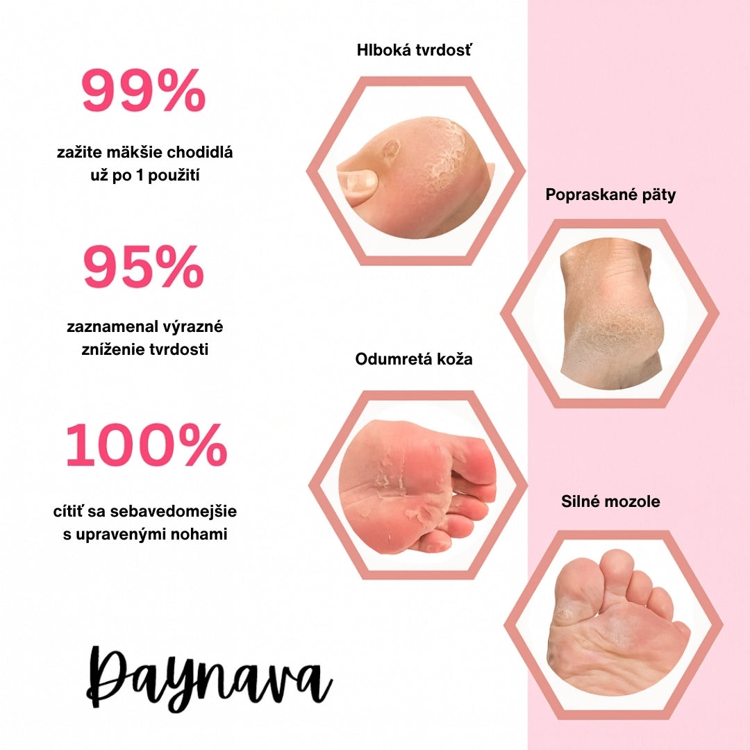 Elektrický pilník na nohy Daynava