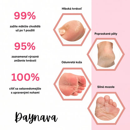 Elektrický pilník na nohy Daynava