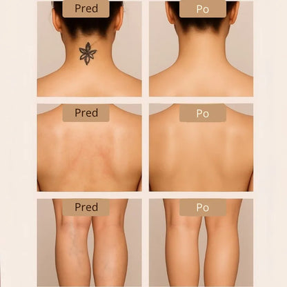 Komplet Čopičev Daynava za Body Perfecter