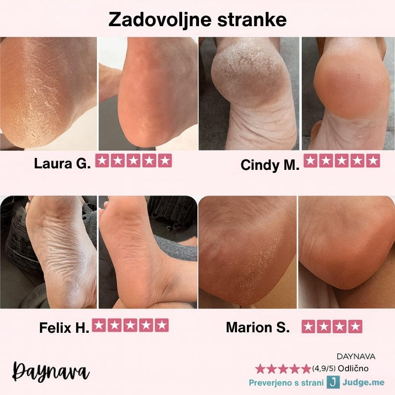 Električna Pilica za Stopala Daynava