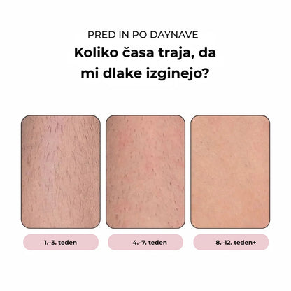 Daynava™ IPL Epilator (SL)