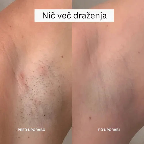 Daynava™ 5 v 1 Električni Brivnik (SL)