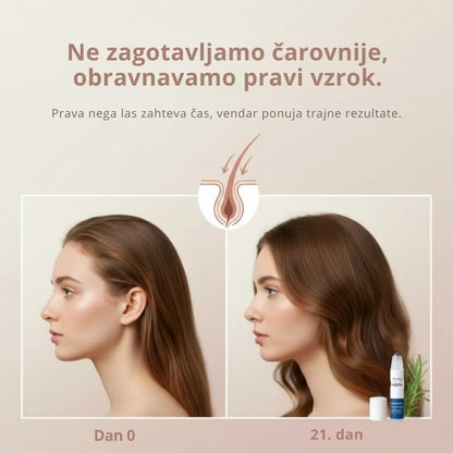 Daynava™ Roll-On za rast las