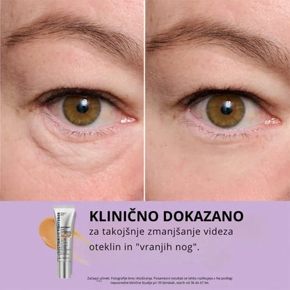 Daynava™ Instantni Dvig Ovaločesnega Predela