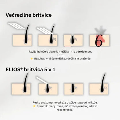 Daynava™ 5 v 1 Električni Brivnik (SL)