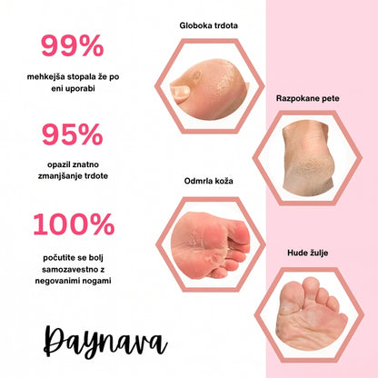 Električna Pilica za Stopala Daynava